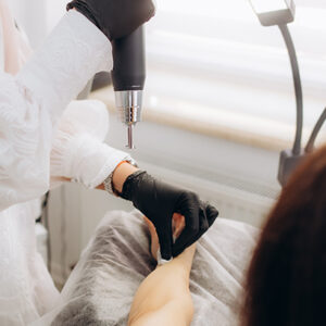 Eliminación de tatuajes y micropigmentación